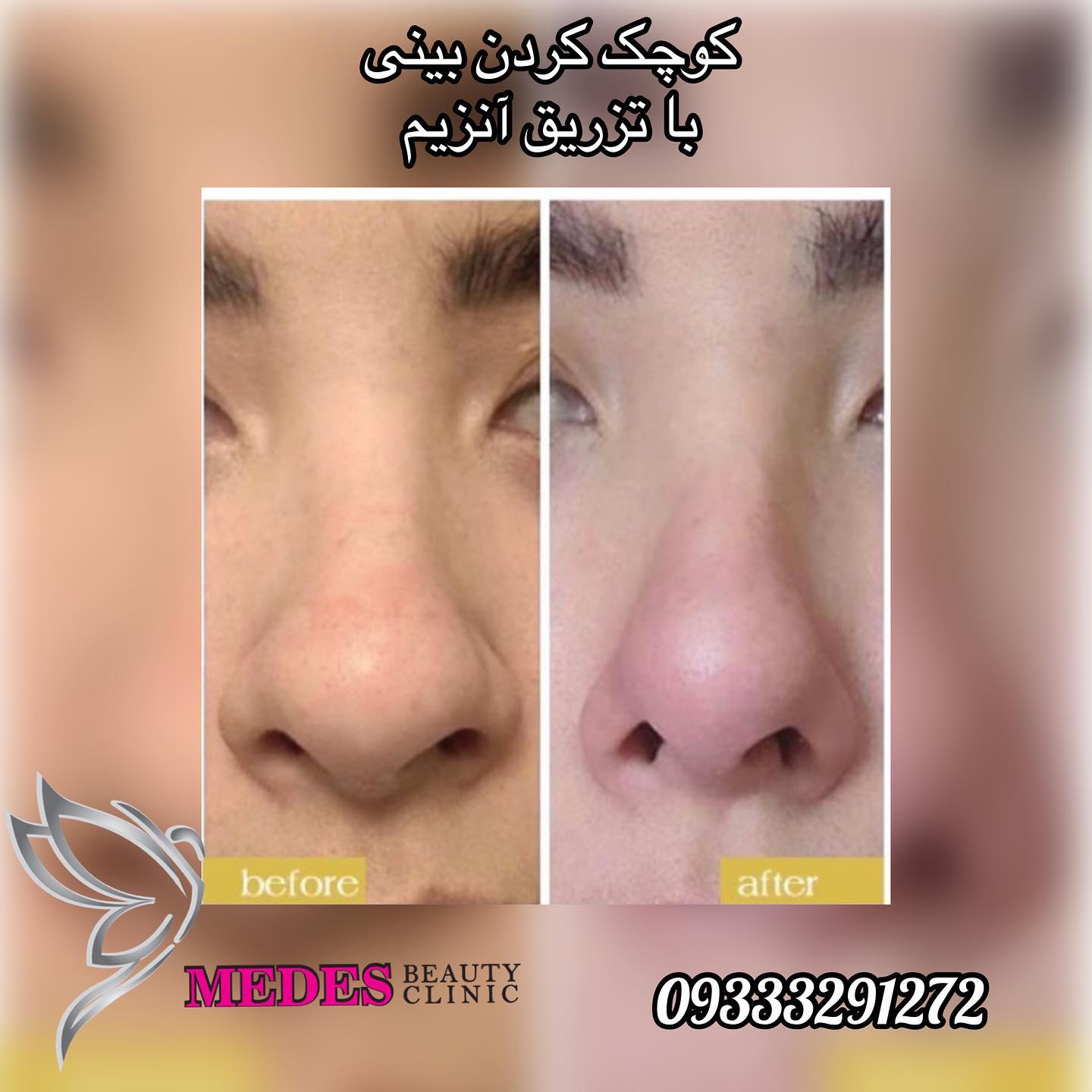 گالری اصلاح فرم بینی